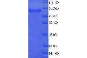 SDS-PAGE (SDS) image for Microtubule-Associated Protein 2 (MAP2) (AA 213-559), (partial) protein (His-SUMO Tag) (ABIN5709895)