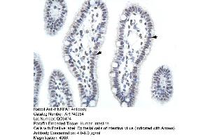 ARP40384 Paraffin Embedded Tissue: Human Intestine Cellular Data: Epithelial cells of intestinal villas Antibody Concentration: 4. (HNRNPA1 anticorps  (C-Term))