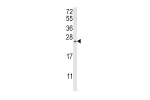 Western blot analysis of RGS4 Antibody (Center) (ABIN652827 and ABIN2842539) in MDA-M cell line lysates (35 μg/lane).
