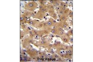 PHF12 Antibody (C-term) (ABIN655082 and ABIN2844716) immunohistochemistry analysis in formalin fixed and paraffin embedded human liver tissue followed by peroxidase conjugation of the secondary antibody and DAB staining. (PHF12 anticorps  (C-Term))