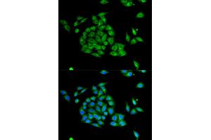 Immunofluorescence analysis of HeLa cells using PICK1 antibody (ABIN6291515). (PICK1 anticorps)