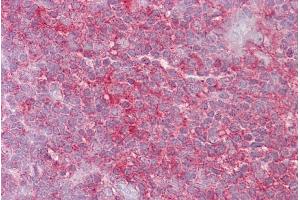 Immunohistochemistry with Thymus tissue at an antibody concentration of 5µg/ml using anti-KIF2A antibody (ARP33902_P050)