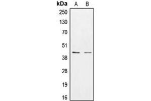 Western blot analysis of CK1 epsilon expression in HEK293T (A), SKBR3 (B) whole cell lysates.