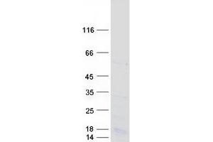 Validation with Western Blot