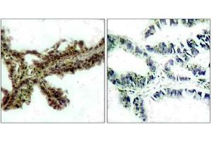Image no. 1 for anti-V-Akt Murine Thymoma Viral Oncogene Homolog 1 (AKT1) (pThr308) antibody (ABIN196710) (AKT1 anticorps  (pThr308))