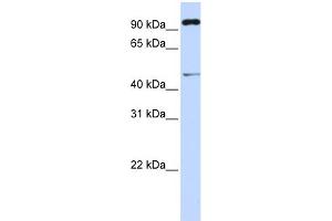 WB Suggested Anti-TRIM15 Antibody Titration: 0. (TRIM15 anticorps  (Middle Region))
