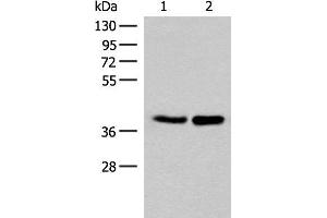 Western blot analysis of HUVEC and PC3 cell lysates using FAM84B Polyclonal Antibody at dilution of 1:400 (FAM84B anticorps)