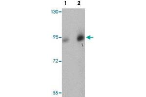 Western blot analysis of human brain tissue with DCLK1 polyclonal antibody  at (Lane 1) 0. (DCLK1 anticorps  (N-Term))
