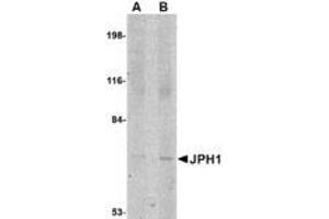 Image no. 1 for anti-Junctophilin 1 (JPH1) (C-Term) antibody (ABIN341697) (Junctophilin 1 anticorps  (C-Term))
