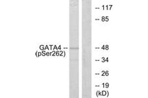 Western blot analysis of extracts from 293 cells, using GATA4 (Phospho-Ser262) Antibody. (GATA4 anticorps  (pSer262))