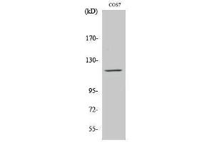 Western Blotting (WB) image for anti-PTK2B Protein tyrosine Kinase 2 beta (PTK2B) (Ser373) antibody (ABIN3177054) (PTK2B anticorps  (Ser373))