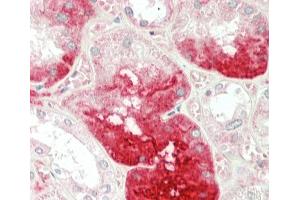 Formalin-fixed and paraffin-embedded H.