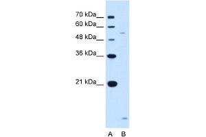 WB Suggested Anti-ST3GAL5 Antibody Titration:  1. (ST3GAL5 anticorps  (N-Term))