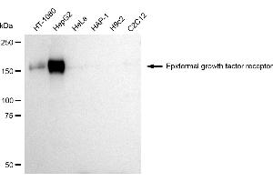 Western blotting analysis using Epidermal growth factor receptor antibody (ABIN7798476). (EGFR anticorps)