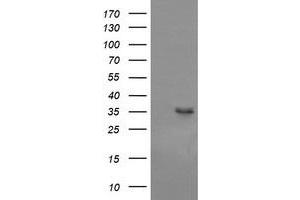 Western Blotting (WB) image for anti-T-cell surface glycoprotein CD1c (CD1C) antibody (ABIN2670669) (CD1c anticorps)