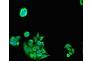 Immunofluorescent analysis of PC-3 cells using ABIN7142238 at dilution of 1:100 and Alexa Fluor 488-congugated AffiniPure Goat Anti-Rabbit IgG(H+L) (PSMC5 anticorps  (Regulatory Subunit 8))
