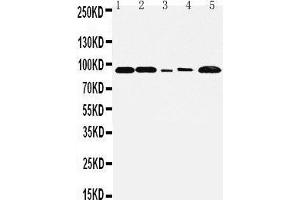 Anti-FGFR1 antibody, Western blotting Lane 1: Rat Liver Tissue Lysate Lane 2: Rat Brain Tissue Lysate Lane 3: SMMC Cell Lysate Lane 4:  Cell Lysate Lane 5: MM231 Cell Lysate