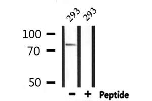 Western blot analysis of extracts from 293, using ADD3 Antibody.