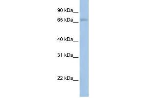 MAP3K2 antibody used at 1 ug/ml to detect target protein.