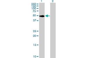 Western Blot analysis of TYR expression in transfected 293T cell line by TYR MaxPab polyclonal antibody. (TYR anticorps  (AA 1-377))