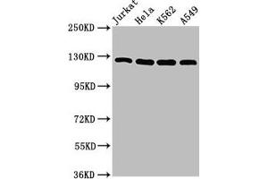 Western Blot Positive WB detected in: Jurkat whole cell lysate, Hela whole cell lysate, K562 whole cell lysate, A549 whole cell lysate All lanes: POLD1 antibody at 5 μg/mL Secondary Goat polyclonal to rabbit IgG at 1/50000 dilution Predicted band size: 124 kDa Observed band size: 124 kDa (POLD1 anticorps  (Catalytic Subunit))
