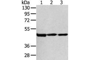 Western Blotting (WB) image for anti-1-Acylglycerol-3-Phosphate O-Acyltransferase 9 (AGPAT9) antibody (ABIN5960644) (AGPAT9 anticorps)