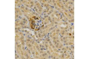 Immunohistochemistry of paraffin-embedded mouse kidney using TNFRSF11B antibody at dilution of 1:200 (x400 lens) (Osteoprotegerin anticorps)