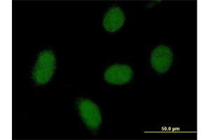 Immunofluorescence of purified MaxPab antibody to C9orf152 on HeLa cell. (C9orf152 anticorps  (AA 1-218))