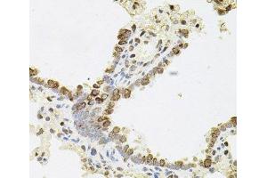 Immunohistochemistry of paraffin-embedded Rat lung using REG3A Polyclonal Antibody (REG3A anticorps)