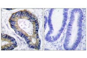 Immunohistochemistry (IHC) image for anti-Eukaryotic Translation Initiation Factor 4E Binding Protein 1 (EIF4EBP1) (Thr70) antibody (ABIN1847930)