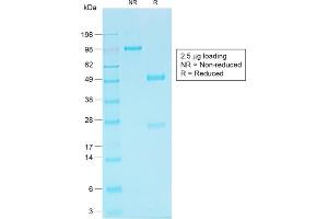 SDS-PAGE Analysis of Purified KSP-Cadherin Rabbit Recombinant Monoclonal Antibody (CDH16/1532R)