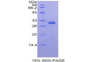 SDS-PAGE analysis of Mouse PRDM1 Protein. (PRDM1 Protéine)