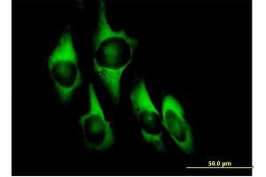 Immunofluorescence of purified MaxPab antibody to EEF1D on HeLa cell.