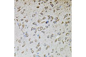 Immunohistochemistry of paraffin-embedded mouse brain using MPO antibody (ABIN4904410) at dilution of 1:100 (40x lens).