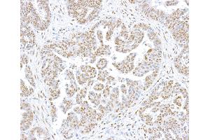 Immunohistochemistry (IHC) image for anti-CCCTC-Binding Factor (Zinc Finger Protein) (CTCF) (AA 650-700) antibody (ABIN7453967) (Recombinant CTCF anticorps  (AA 650-700))
