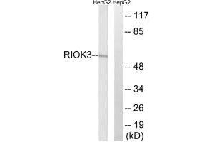 Western blot analysis of extracts from HepG2 cells, using RIOK3 antibody. (RIOK3 anticorps)