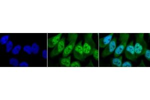 Immunocytochemistry/Immunofluorescence analysis using Rabbit Anti-Phosphothreonine Polyclonal Antibody (ABIN361757). (Phosphothreonine anticorps)