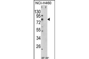 Western blot analysis of ACSS3 Antibody (Center) (ABIN652520 and ABIN2842349) in NCI- cell line lysates (35 μg/lane). (ACSS3 anticorps  (AA 224-251))