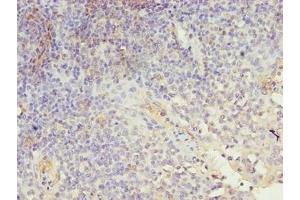 Immunohistochemistry of paraffin-embedded human tonsil tissue using ABIN7158082 at dilution of 1:100 (LRRN1 anticorps  (AA 26-631))