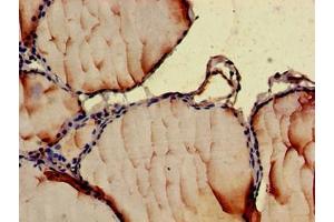 Immunohistochemistry of paraffin-embedded human thyroid tissue using ABIN7145998 at dilution of 1:100