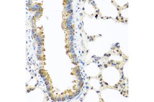 Immunohistochemistry of paraffin-embedded rat lung using C8orf4 antibody at dilution of 1:100 (40x lens). (C8orf4 anticorps)