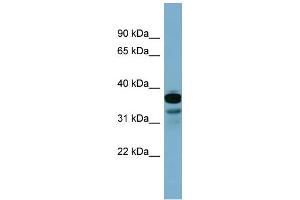 WB Suggested Anti-FLJ25791 Antibody Titration: 0. (FLJ25791 (Middle Region) anticorps)