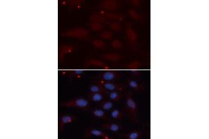 Immunofluorescence analysis of U2OS cell using KPNA1 antibody.