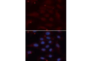 Immunofluorescence analysis of U2OS cell using KPNA1 antibody. (KPNA1 anticorps  (AA 1-300))