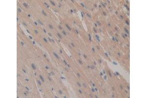 Used in DAB staining on fromalin fixed paraffin- embedded Kidney tissue (Caspase 12 anticorps  (AA 1-413))