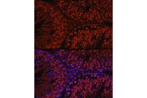 Immunofluorescence analysis of rat testis using C1orf146 Rabbit pAb (ABIN7266368) at dilution of 1:100 (40x lens). (C1ORF146 anticorps)