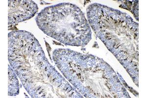 IHC analysis of FMN1 using anti-FMN1 antibody . (FMN1 anticorps  (AA 1195-1419))