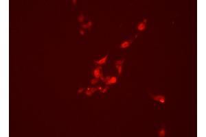 F6318 staining HEPG2 cells by ICC/IF. (PML anticorps  (N-Term))