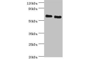 Western blot All lanes: ATAD3B antibody at 2 μg/mL Lane 1: Jurkat whole cell lysate Lane 2: Hela whole cell lysate Secondary Goat polyclonal to rabbit IgG at 1/10000 dilution Predicted band size: 73, 20, 68 kDa Observed band size: 73 kDa