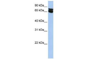 B4GALNT1 antibody used at 1 ug/ml to detect target protein.